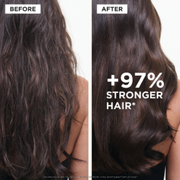 KER_chronologiste_overnightyouthserum_beforeandafter